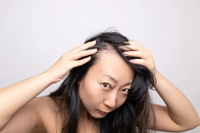 Jerawat di Garis Rambut
